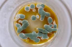 Importance of Water Microbiology